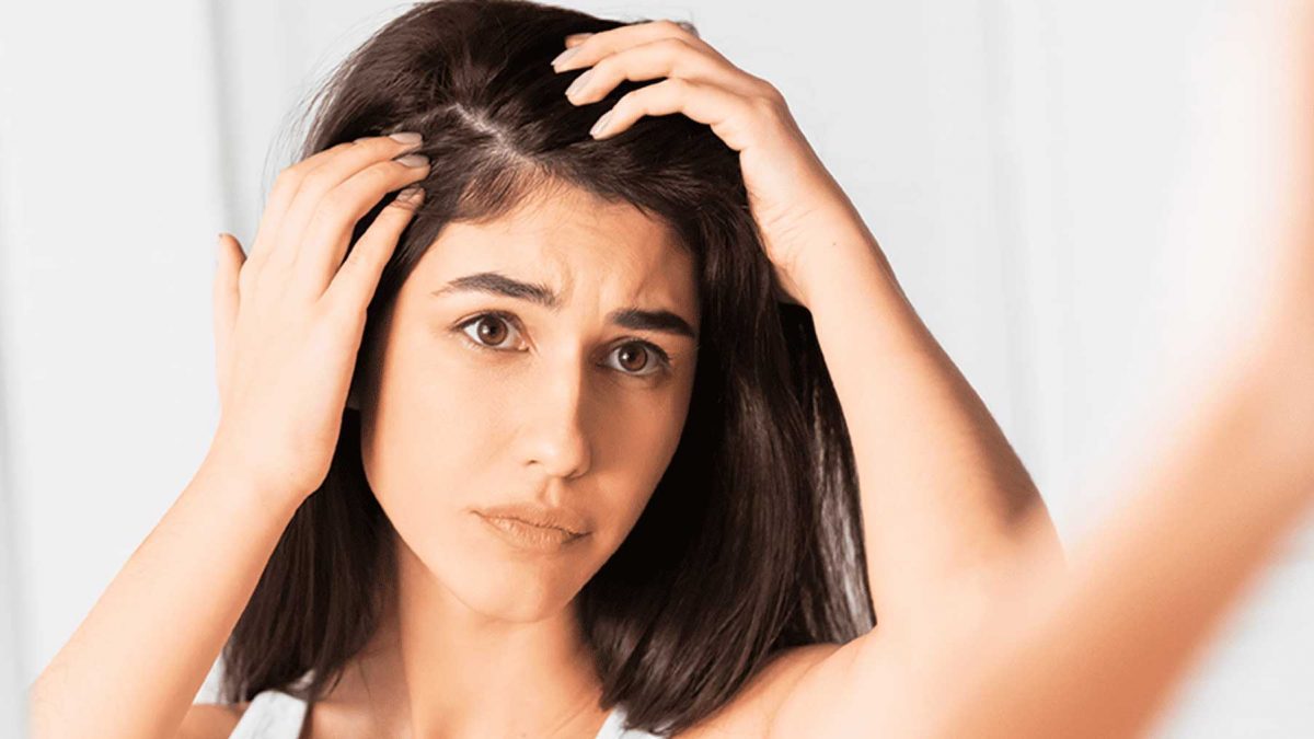 como evitar la caspa