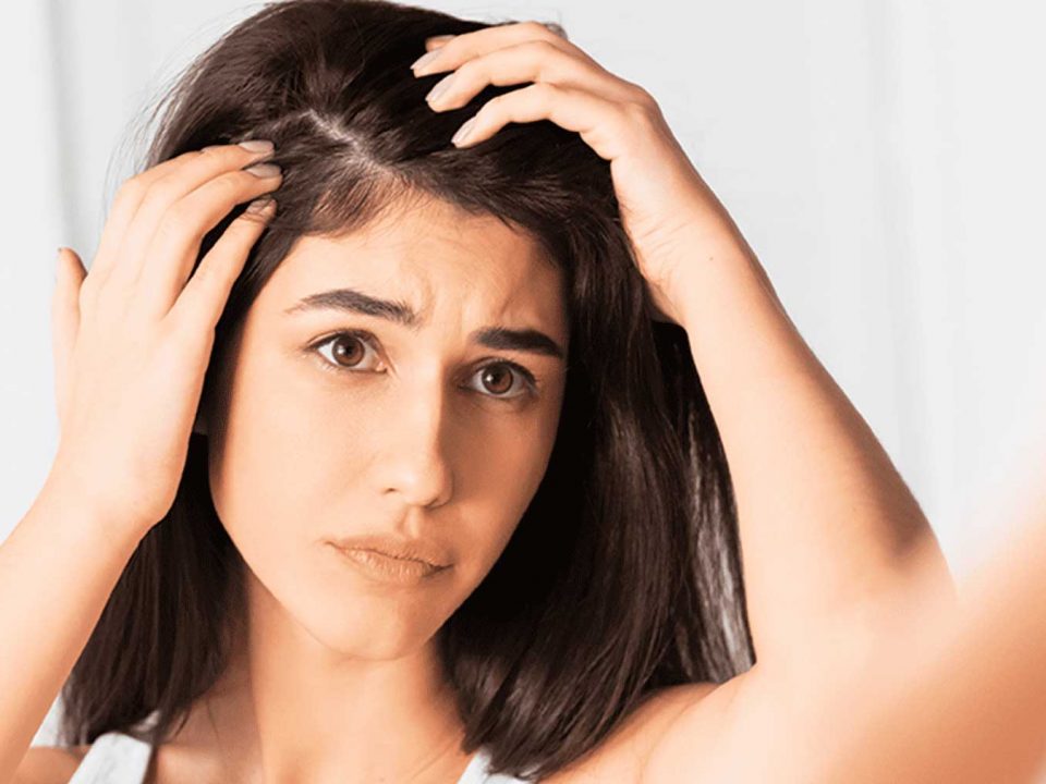 como evitar la caspa